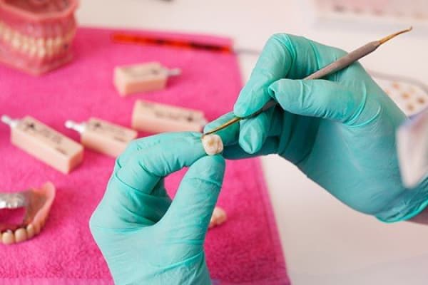 Tandtechnicus werkt aan een kroon in het lab